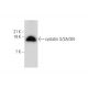 cystatin S/SA/SN Antibody (Z8983) - Western Blotting - Image 333861