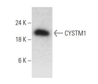 CYSTM1 Antibody (1-RE17) - Western Blotting - Image 385154 