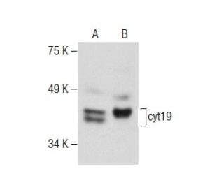 cyt19 Antibody (F-9) - Western Blotting - Image 284501 