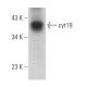 cyt19 Antibody (F-9) - Western Blotting - Image 364352 