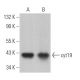 cyt19 Antibody (F-9) - Western Blotting - Image 364353