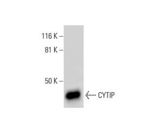 CYTIP Antibody (E-12) - Western Blotting - Image 289545