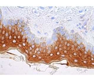 Cytokeratin 1/10 Antibody (LH1) - Immunohistochemistry - Image 383485 