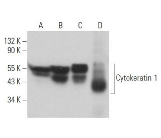 Cytokeratin 1 Antibody (4D12B3) - Western Blotting - Image 367493 