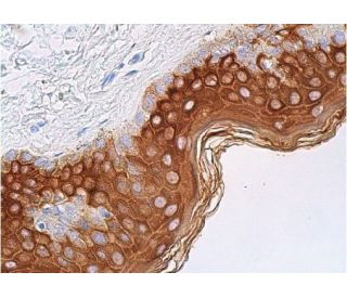 Cytokeratin 1 Antibody (E-12) - Immunohistochemistry - Image 365241 
