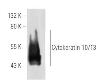 Cytokeratin 10/13 Antibody (0.N.355) - Western Blotting - Image 32800