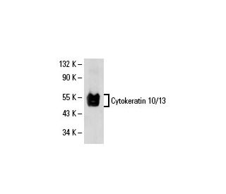 Cytokeratin 10/13 Antibody (4A28) - Western Blotting - Image 19291 