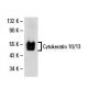 Cytokeratin 10/13 Antibody (4A28) - Western Blotting - Image 19291 