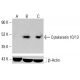 Cytokeratin 10/13 Antibody (4A28) - Western Blotting - Image 413271