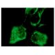 Cytokeratin 10/13 Antibody (DE-K13) - Immunofluorescence - Image 160116