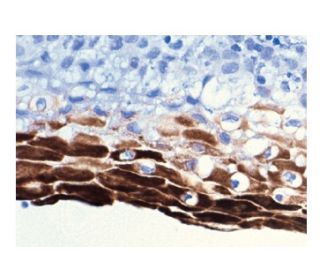 Cytokeratin 10/13 Antibody (DE-K13) - Immunohistochemistry - Image 160115 