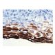 Cytokeratin 10/13 Antibody (DE-K13) - Immunohistochemistry - Image 160115 