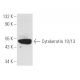 Cytokeratin 10/13 Antibody (DE-K13) - Western Blotting - Image 5358 