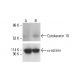 Cytokeratin 10 Antibody (4A27) - Western Blotting - Image 412171
