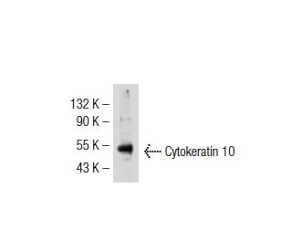 Cytokeratin 10 Antibody (AE20) - Western Blotting - Image 32799 