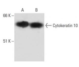 Cytokeratin 10 Antibody (DE-K10) - Western Blotting - Image 17439