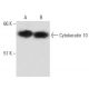Cytokeratin 10 Antibody (DE-K10) - Western Blotting - Image 17439