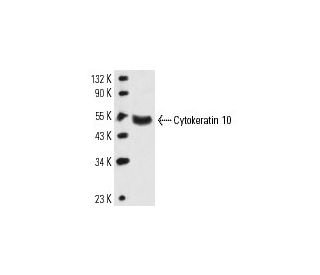 Cytokeratin 10 Antibody (LH2) - Western Blotting - Image 14139 