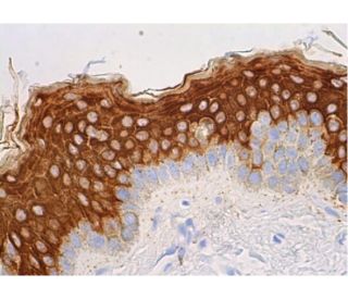 Cytokeratin 10 Antibody (RKSE60) - Immunohistochemistry - Image 383482 