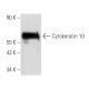 Cytokeratin 10 Antibody (VIK-10) - Western Blotting - Image 12463 
