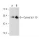 Cytokeratin 10 Antibody (VIK-10) - Western Blotting - Image 31328