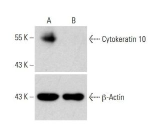 Cytokeratin 10 Antibody (VIK-10) - Western Blotting - Image 321801 