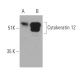 Cytokeratin 12 Antibody (E-8) - Western Blotting - Image 371029 