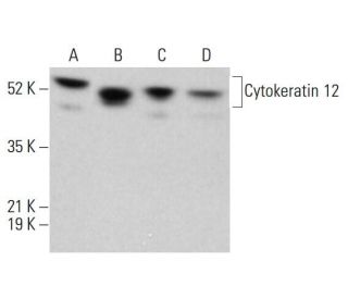 Cytokeratin 12 Antibody (E-8) - Western Blotting - Image 380344 