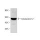 Cytokeratin 12 Antibody (E-8) - Western Blotting - Image 381161