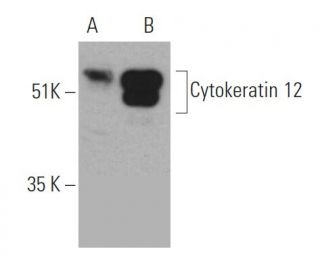 Cytokeratin 12 Antibody (E-8) - Western Blotting - Image 371029 