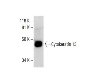 Cytokeratin 13 Antibody (A-3) - Western Blotting - Image 291859 