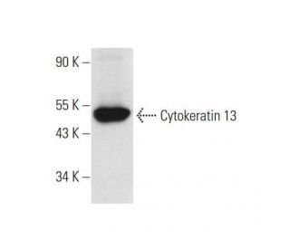 Cytokeratin 13 Antibody (A-5) - Western Blotting - Image 294584 