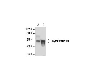 Cytokeratin 13 Antibody (AE8) - Western Blotting - Image 18035 