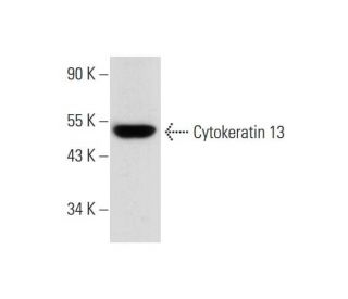Cytokeratin 13 Antibody (B-2) - Western Blotting - Image 294585 