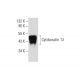 Cytokeratin 13 Antibody (Ks13.1) - Western Blotting - Image 62204