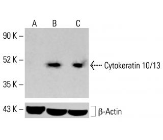 Cytokeratin 10/13 Antibody (4A28) - Western Blotting - Image 413271