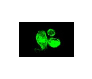 Cytokeratin 14 Antibody (RCK107) - Immunofluorescence - Image 5365