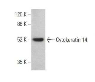 Cytokeratin 14 Antibody (LL001) - Western Blotting - Image 374438 