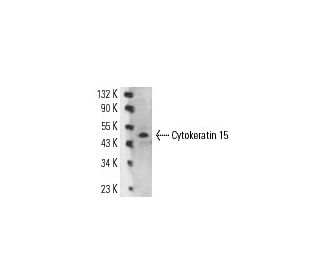 Cytokeratin 15 Antibody (LHK15) - Western Blotting - Image 14543Each CRISPR/Cas9 Knockout (KO) Plasmid product consists of a pool of 3 plasmids designed to ensure identification and cleavage of a specific gene for maximum knockout efficiency. Each plasmid encodes a unique 20 nt sequence derived from the GeCKO (v2) library.