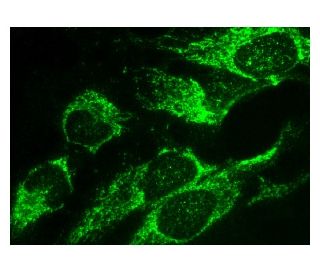 Cytokeratin 16 Antibody (F-2) - Immunofluorescence - Image 156862 