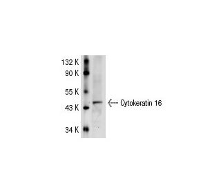 Cytokeratin 16 Antibody (LL025) - Western Blotting - Image 31317 