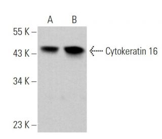 Cytokeratin 16 Antibody (E-10) - Western Blotting - Image 359217