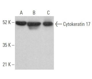 Cytokeratin 17 Antibody (D-4) - Western Blotting - Image 362956 