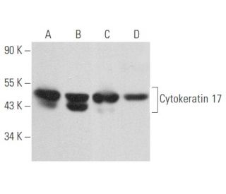 Cytokeratin 17 Antibody (E-4) - Western Blotting - Image 357429 