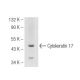 Cytokeratin 17 Antibody (Ks17.E3) - Western Blotting - Image 93609