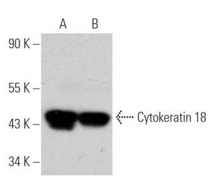 Cytokeratin 18 Antibody (2X44) - Western Blotting - Image 366635 