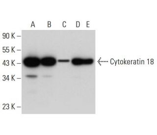 Cytokeratin 18 Antibody (B-6) - Western Blotting - Image 309711 