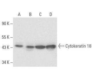 Cytokeratin 18 Antibody (B23.1.) - Western Blotting - Image 15471 
