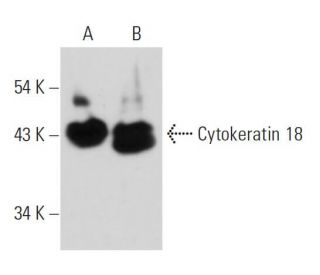 Cytokeratin 18 Antibody (DA-7) - Western Blotting - Image 12562 