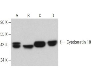 Cytokeratin 18 Antibody (DC-10) - Western Blotting - Image 370859 